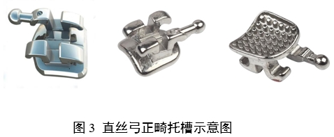 正畸托槽注冊審查指導原則(2022年第41號)(圖3) 正畸托槽注冊審查指導原則(2022年第41號)(圖3)