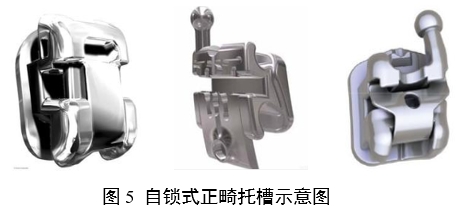 正畸托槽注冊審查指導原則(2022年第41號)(圖5) 正畸托槽注冊審查指導原則(2022年第41號)(圖5)