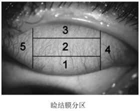 接觸鏡護理產(chǎn)品注冊審查指導(dǎo)原則(2023年修訂版)(2023年第9號)(圖7) 接觸鏡護理產(chǎn)品注冊審查指導(dǎo)原則(2023年修訂版)(2023年第9號)(圖7)