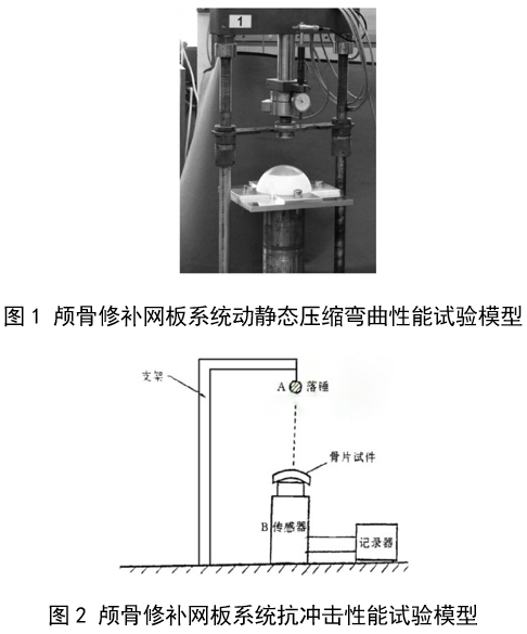 顱骨修補網(wǎng)板系統(tǒng)注冊審查指導(dǎo)原則(2025年第6號)(圖1) 顱骨修補網(wǎng)板系統(tǒng)注冊審查指導(dǎo)原則(2025年第6號)(圖1)