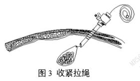 一次性使用內(nèi)窺鏡用活檢袋注冊審查指導(dǎo)原則(2025年第20號)(圖3) 一次性使用內(nèi)窺鏡用活檢袋注冊審查指導(dǎo)原則(2025年第20號)(圖3)