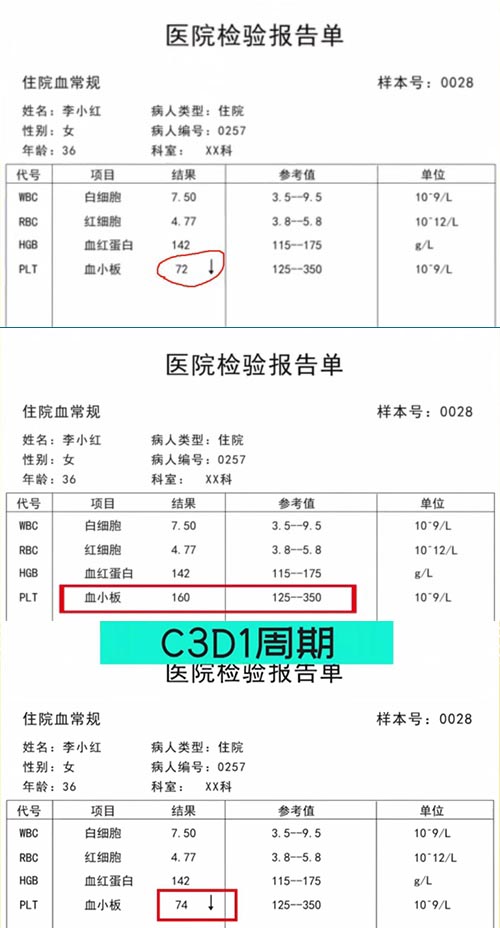 AE與研究藥物關系記錄不一致，如何處理？